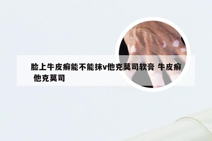 脸上牛皮癣能不能抹v他克莫司软膏 牛皮癣 他克莫司