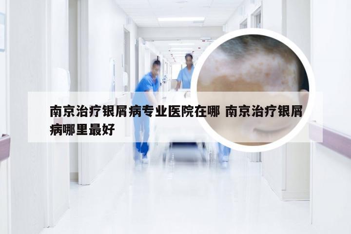 南京治疗银屑病专业医院在哪 南京治疗银屑病哪里最好