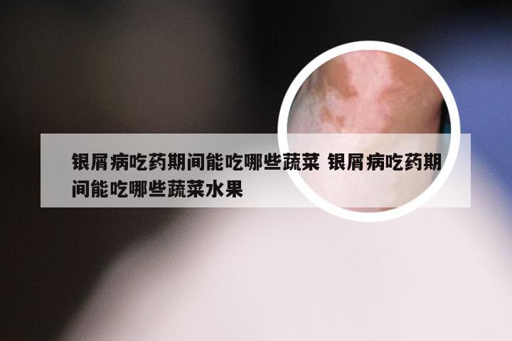 银屑病吃药期间能吃哪些蔬菜 银屑病吃药期间能吃哪些蔬菜水果