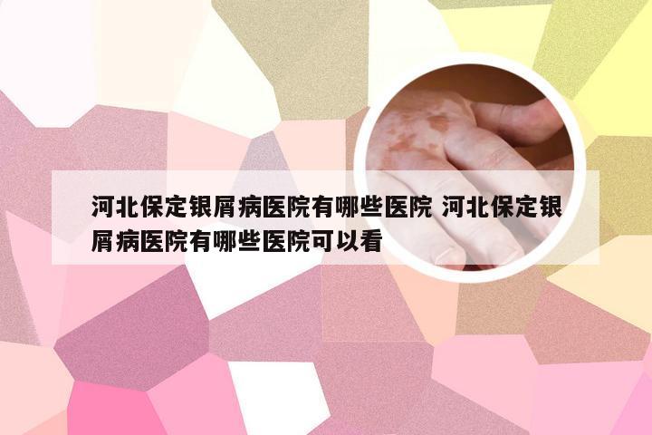 河北保定银屑病医院有哪些医院 河北保定银屑病医院有哪些医院可以看