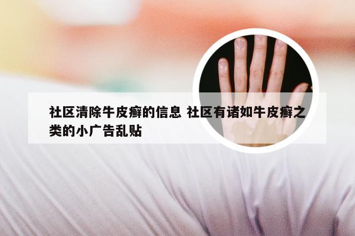 社区清除牛皮癣的信息 社区有诸如牛皮癣之类的小广告乱贴