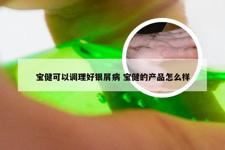 宝健可以调理好银屑病 宝健的产品怎么样