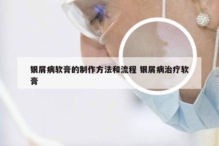 银屑病软膏的制作方法和流程 银屑病治疗软膏
