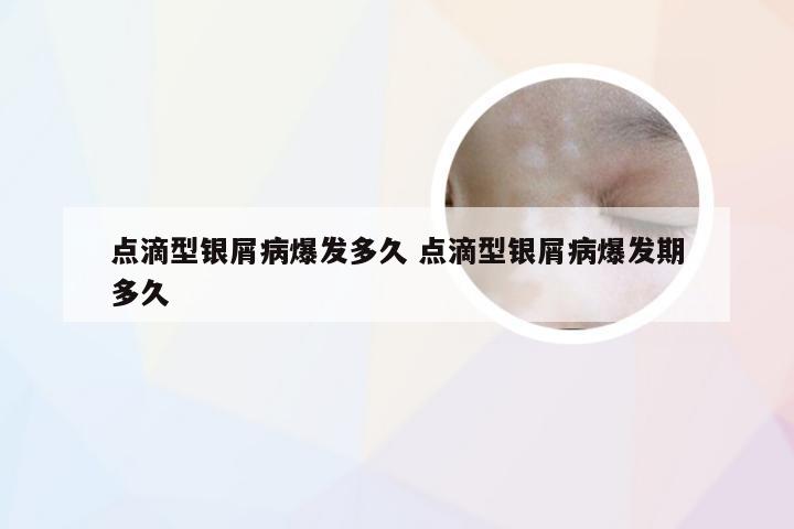 点滴型银屑病爆发多久 点滴型银屑病爆发期多久