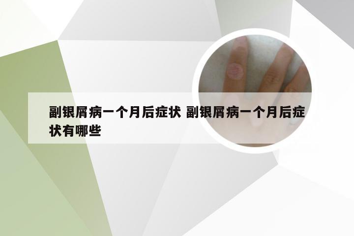 副银屑病一个月后症状 副银屑病一个月后症状有哪些