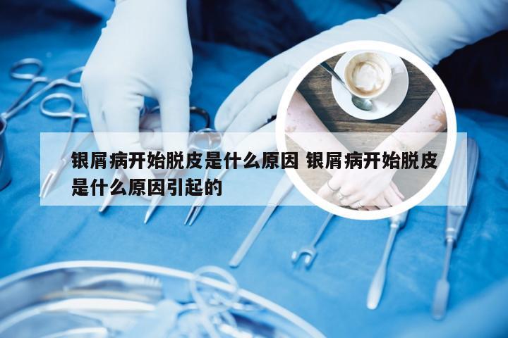 银屑病开始脱皮是什么原因 银屑病开始脱皮是什么原因引起的