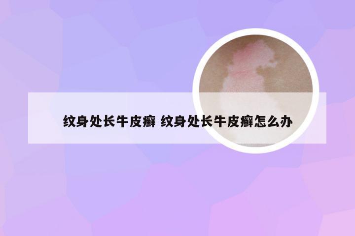 纹身处长牛皮癣 纹身处长牛皮癣怎么办