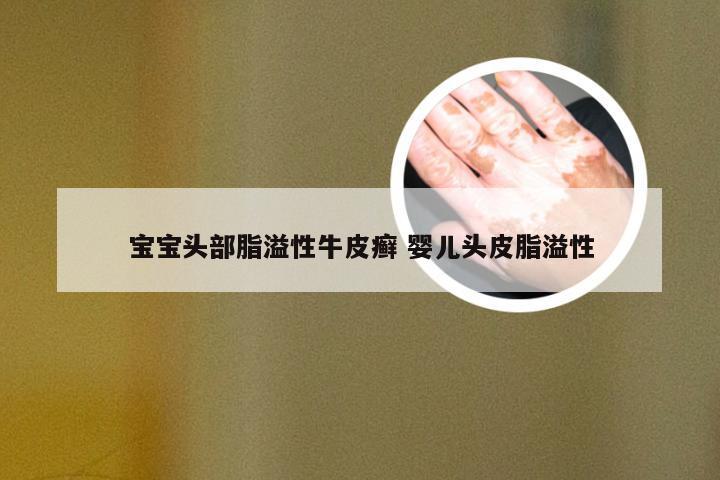 宝宝头部脂溢性牛皮癣 婴儿头皮脂溢性