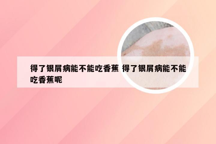 得了银屑病能不能吃香蕉 得了银屑病能不能吃香蕉呢