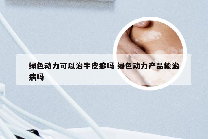 绿色动力可以治牛皮癣吗 绿色动力产品能治病吗