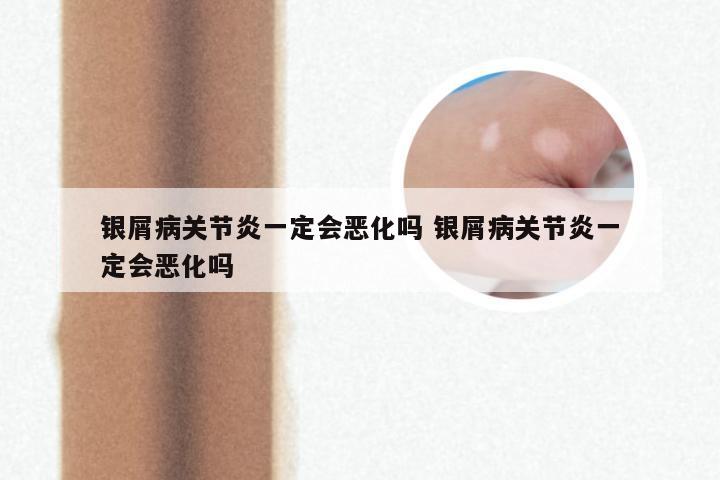 银屑病关节炎一定会恶化吗 银屑病关节炎一定会恶化吗
