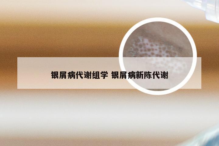 银屑病代谢组学 银屑病新陈代谢
