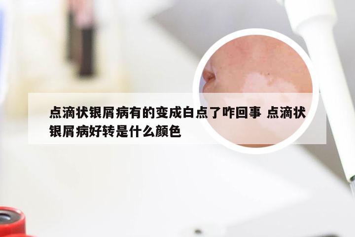 点滴状银屑病有的变成白点了咋回事 点滴状银屑病好转是什么颜色