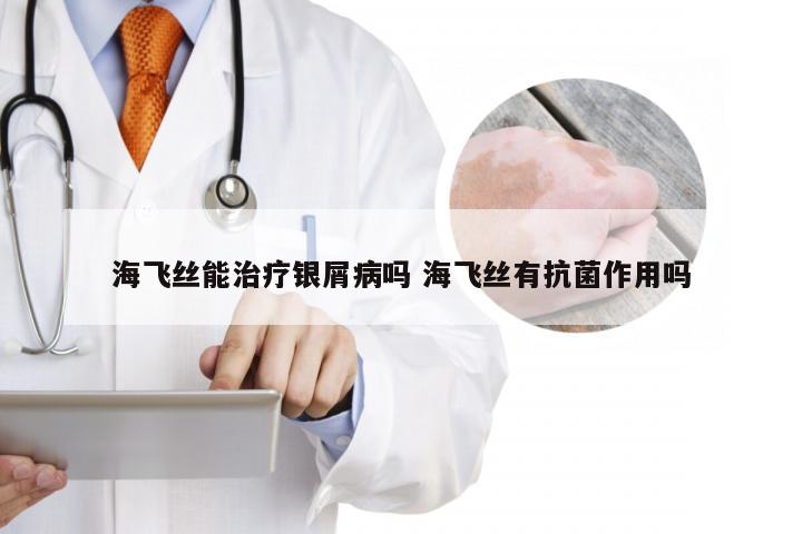 海飞丝能治疗银屑病吗 海飞丝有抗菌作用吗