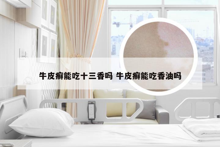 牛皮癣能吃十三香吗 牛皮癣能吃香油吗