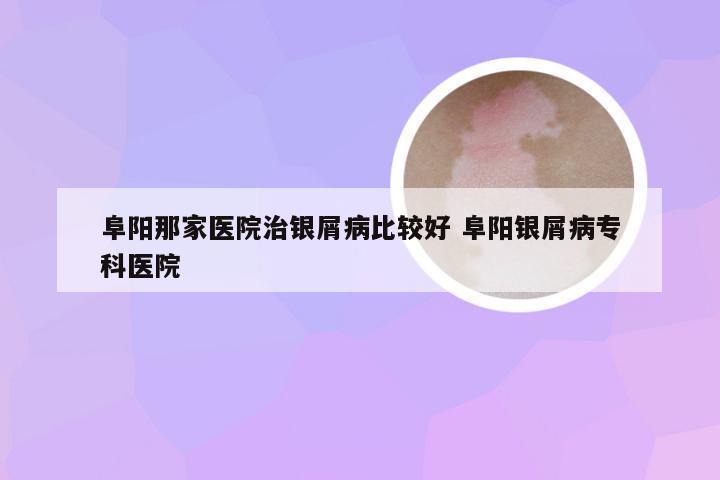 阜阳那家医院治银屑病比较好 阜阳银屑病专科医院
