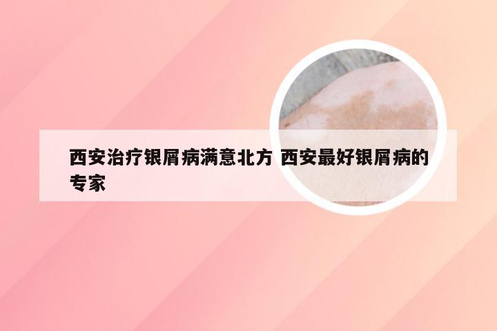 西安治疗银屑病满意北方 西安最好银屑病的专家
