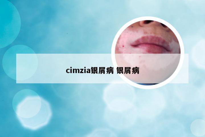 cimzia银屑病 银屑病