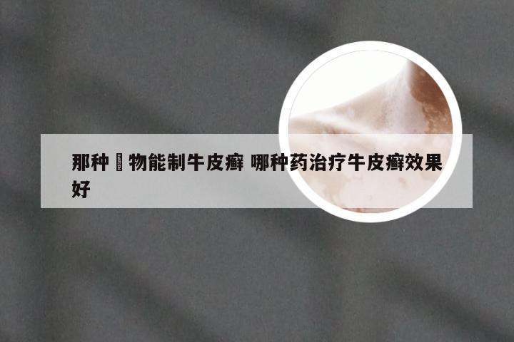那种葯物能制牛皮癣 哪种药治疗牛皮癣效果好