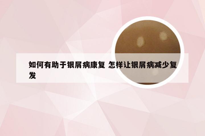 如何有助于银屑病康复 怎样让银屑病减少复发