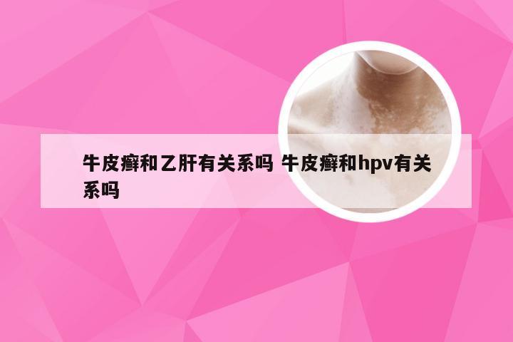 牛皮癣和乙肝有关系吗 牛皮癣和hpv有关系吗