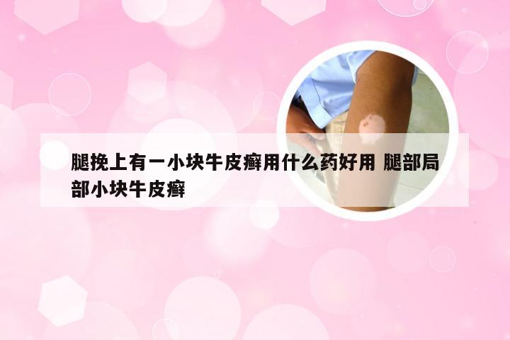 腿挽上有一小块牛皮癣用什么药好用 腿部局部小块牛皮癣