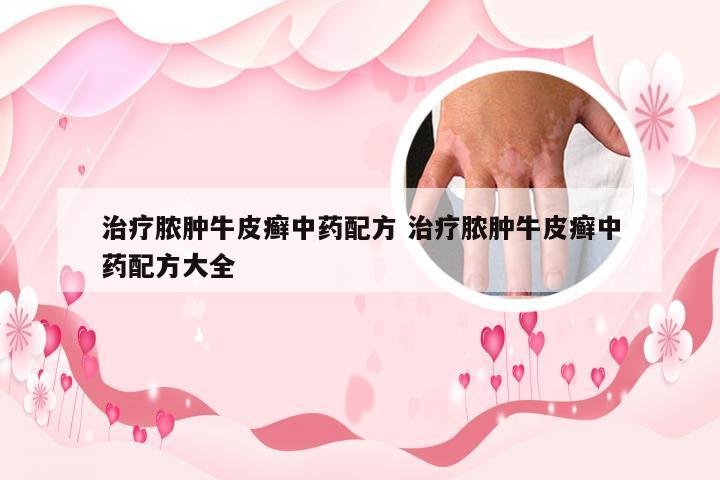 治疗脓肿牛皮癣中药配方 治疗脓肿牛皮癣中药配方大全