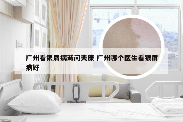 广州看银屑病诚问夫康 广州哪个医生看银屑病好