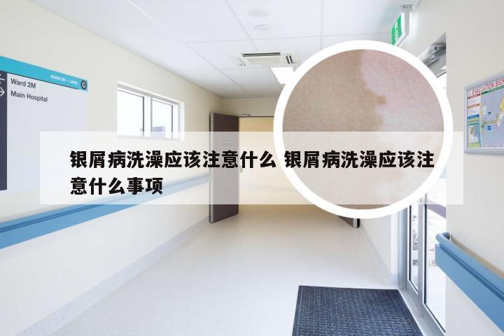 银屑病洗澡应该注意什么 银屑病洗澡应该注意什么事项