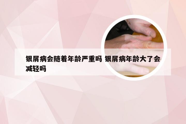 银屑病会随着年龄严重吗 银屑病年龄大了会减轻吗