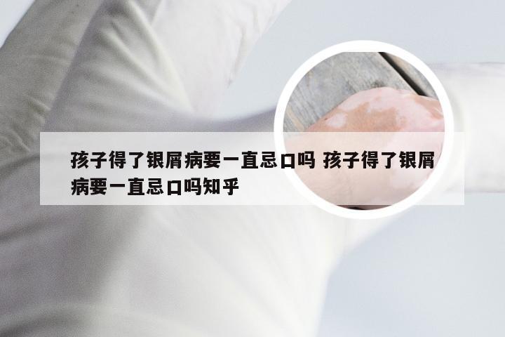 孩子得了银屑病要一直忌口吗 孩子得了银屑病要一直忌口吗知乎