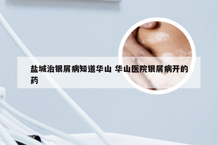 盐城治银屑病知道华山 华山医院银屑病开的药