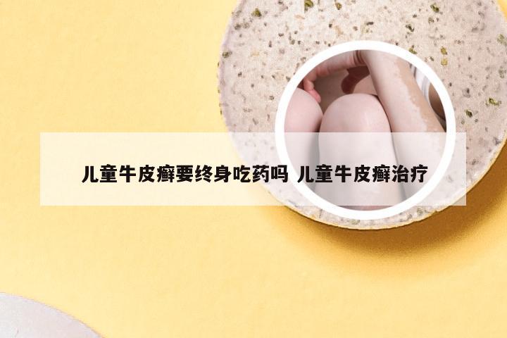 儿童牛皮癣要终身吃药吗 儿童牛皮癣治疗