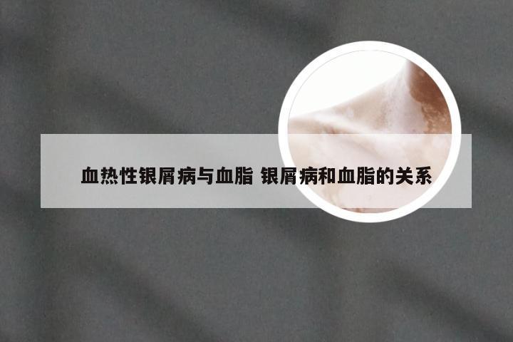 血热性银屑病与血脂 银屑病和血脂的关系