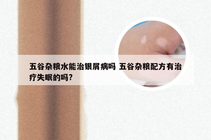 五谷杂粮水能治银屑病吗 五谷杂粮配方有治疗失眠的吗?