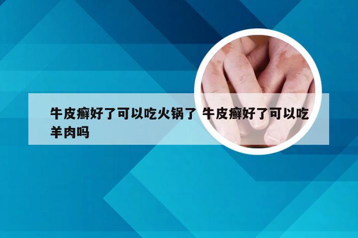 牛皮癣好了可以吃火锅了 牛皮癣好了可以吃羊肉吗