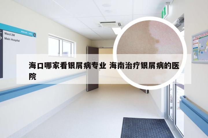 海口哪家看银屑病专业 海南治疗银屑病的医院