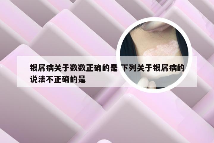 银屑病关于数数正确的是 下列关于银屑病的说法不正确的是