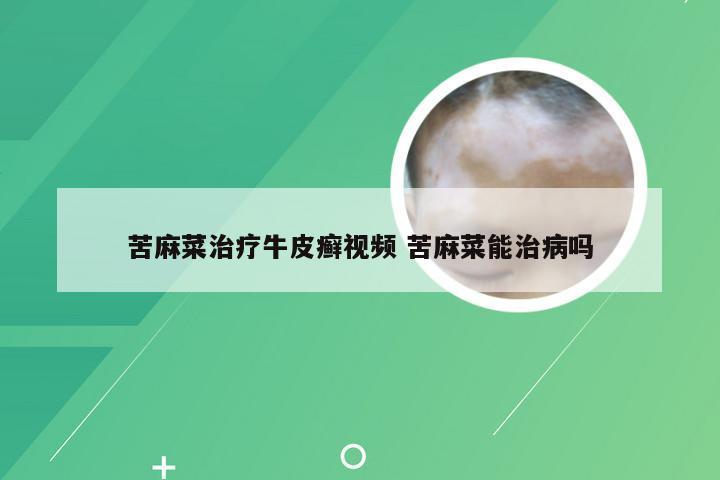 苦麻菜治疗牛皮癣视频 苦麻菜能治病吗