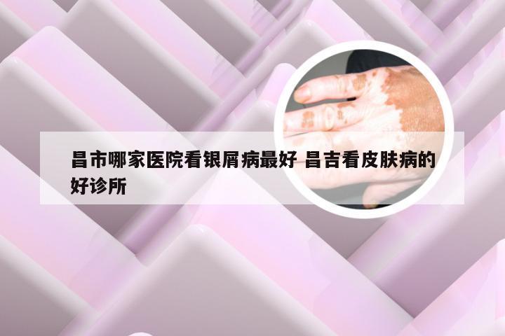 昌市哪家医院看银屑病最好 昌吉看皮肤病的好诊所