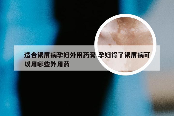 适合银屑病孕妇外用药膏 孕妇得了银屑病可以用哪些外用药