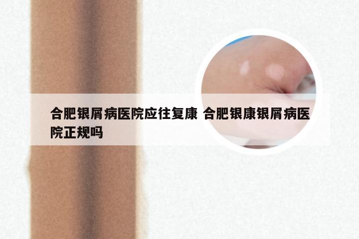 合肥银屑病医院应往复康 合肥银康银屑病医院正规吗