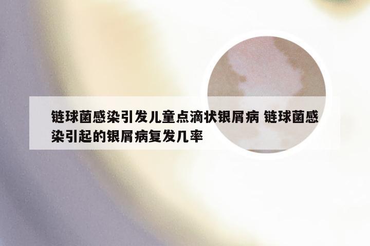 链球菌感染引发儿童点滴状银屑病 链球菌感染引起的银屑病复发几率