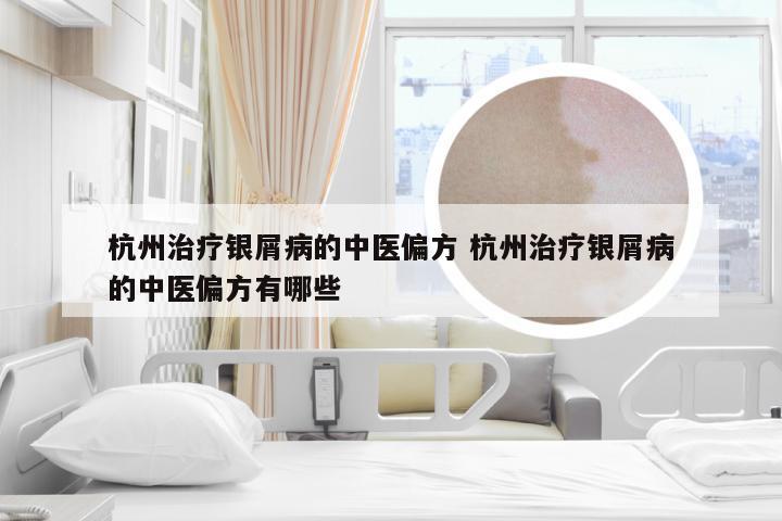 杭州治疗银屑病的中医偏方 杭州治疗银屑病的中医偏方有哪些