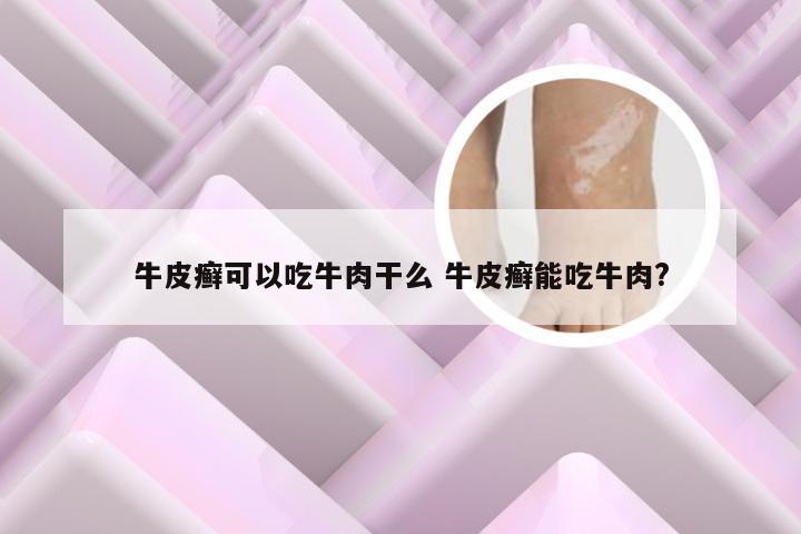 牛皮癣可以吃牛肉干么 牛皮癣能吃牛肉?