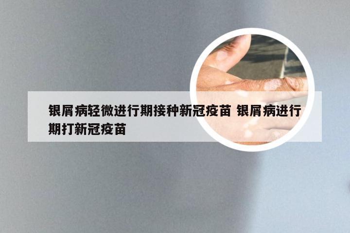 银屑病轻微进行期接种新冠疫苗 银屑病进行期打新冠疫苗