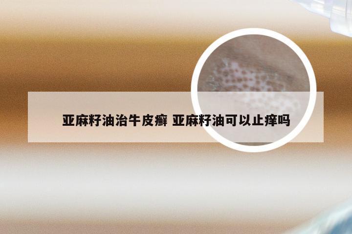 亚麻籽油治牛皮癣 亚麻籽油可以止痒吗