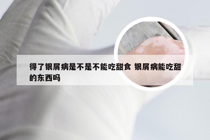 得了银屑病是不是不能吃甜食 银屑病能吃甜的东西吗