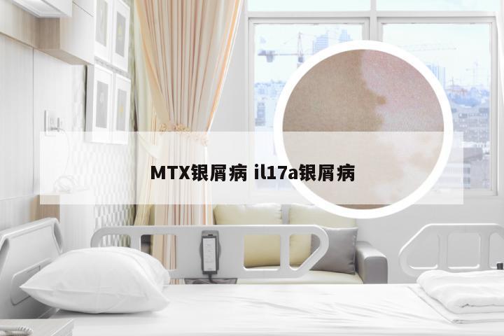 MTX银屑病 il17a银屑病