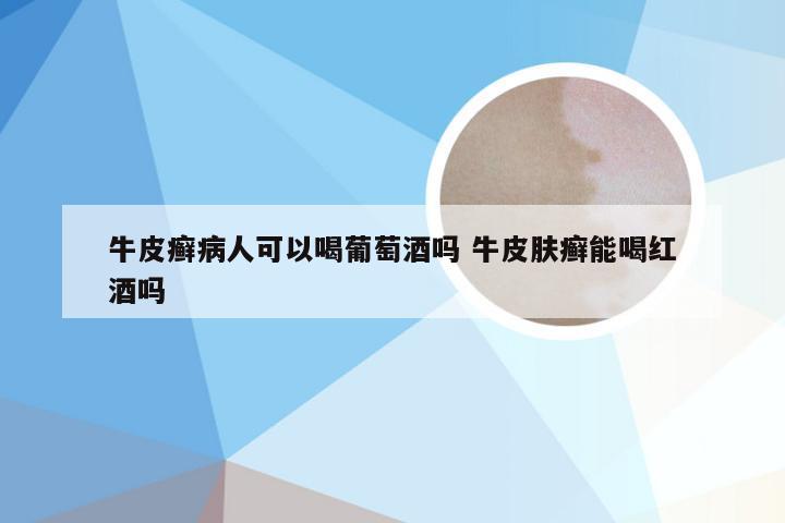 牛皮癣病人可以喝葡萄酒吗 牛皮肤癣能喝红酒吗